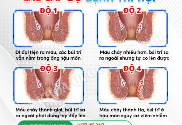 dang-bi-tri-noi-kiem-tra-ngay-de-biet-ban-thuoc-cap-do-nao
