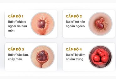 dia-chi-kham-tri-ngoai-co-bac-si-gioi-lam-ngoai-gio-hanh-chinh-nhieu-nguoi-hoi-han-vi-khong-biet-den-som-hon