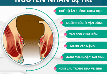 benh-tri-do-dau-90-nguoi-mac-khong-ngo-nguyen-nhan-den-tu-thoi-quen-nay
