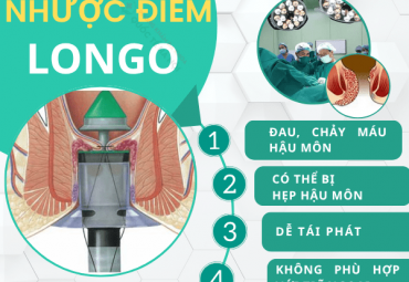 pph-hcpt-hay-laser-cat-tri-bang-phuong-phap-nao-do-dau-it-chay-mau-hon