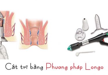 cat-tri-bang-logo-co-phai-la-phuong-phap-toi-uu-nhat-hien-nay
