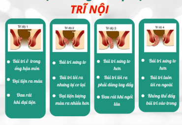 tat-tan-tat-ve-benh-tri-nguyen-nhan-dau-hieu-va-cach-dieu-tri-hieu-qua